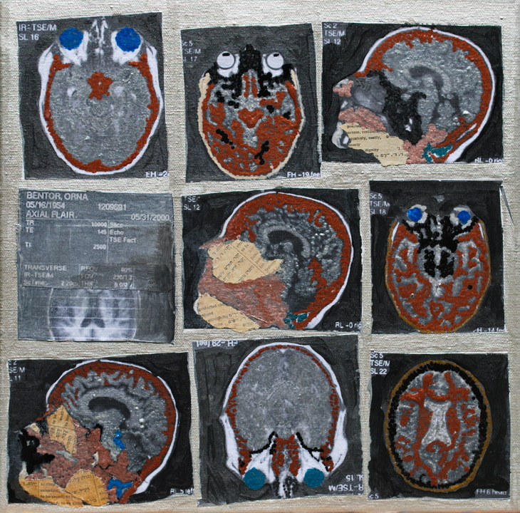 Brainchild #2